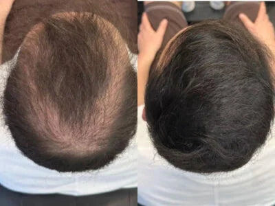 Cache-Cheveux Minéral — photo d'un client 3