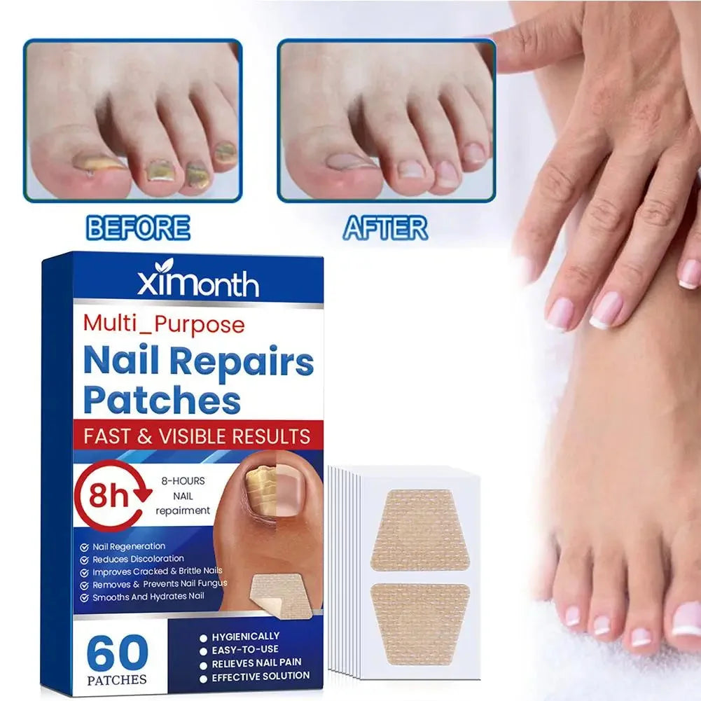 Parches Reparadores Discretos para Uñas con Hongos — foto 3
